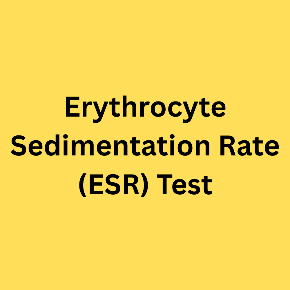 1 Erythrocyte Sedimentation Rate (ESR) Test - Image 1